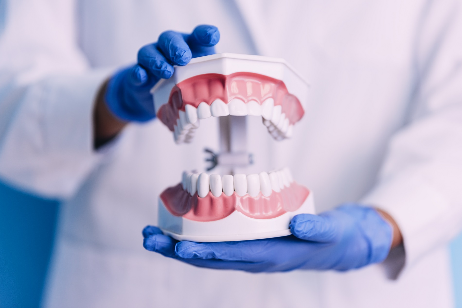Cuidados posteriores a la colocación de implantes dentales para mantener tus dientes en perfecto estado