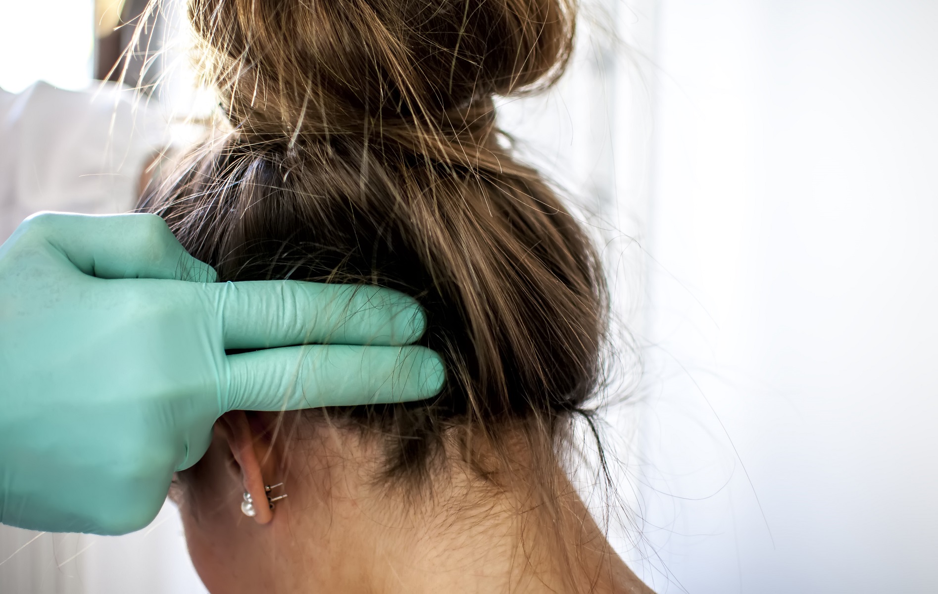 como cuidar el cuero cabelludo