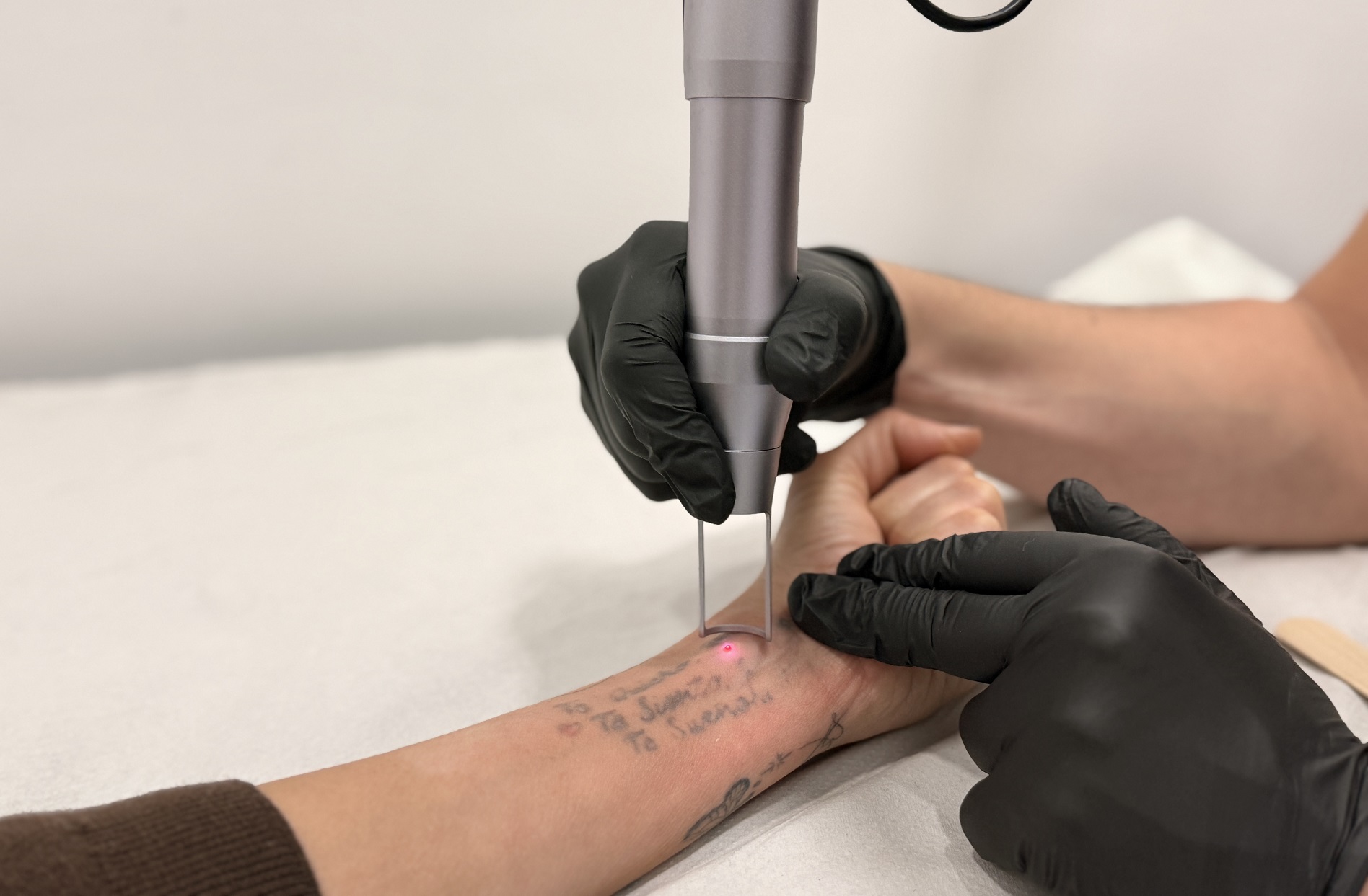 clinicas de eliminacion de tatuajes